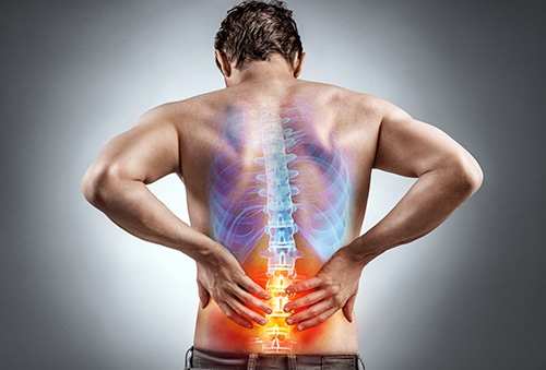 Sciatica