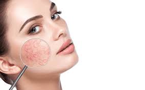 Dermatological Disorders