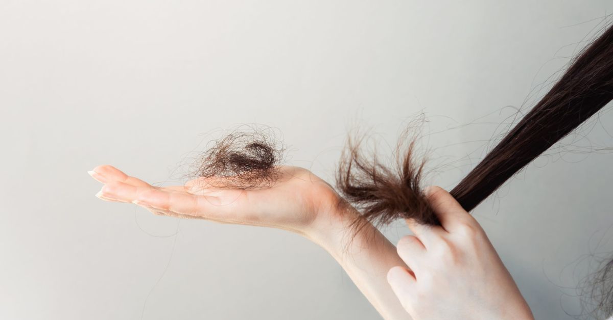 Hair Disorders