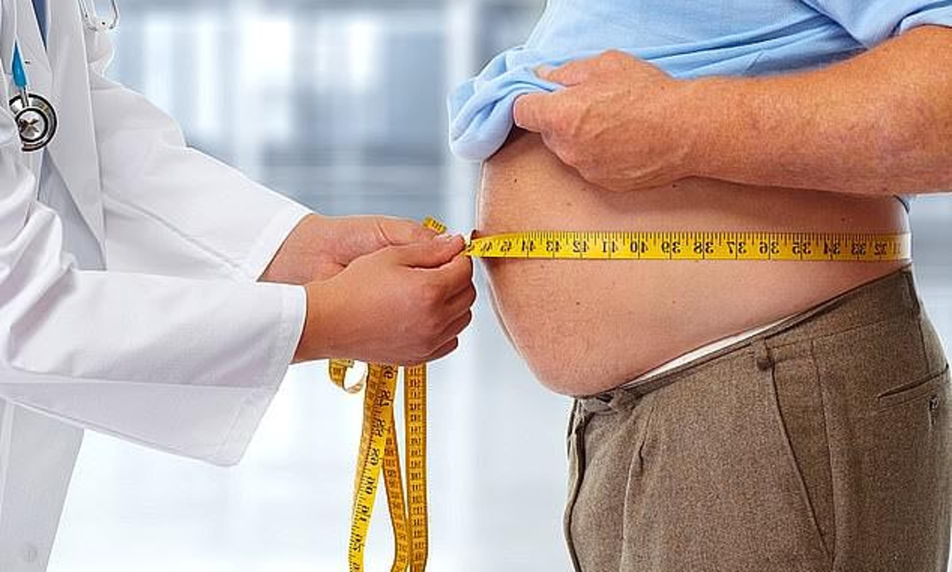 Obesity